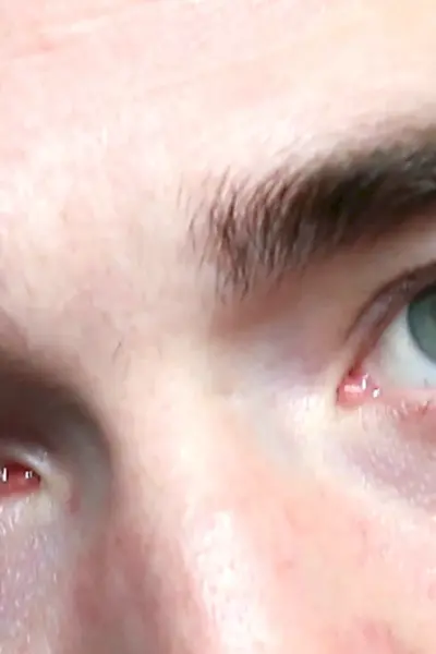 SANPAKU Eyes